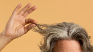 alopecie caderea parului