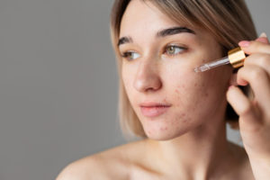 skin with acne