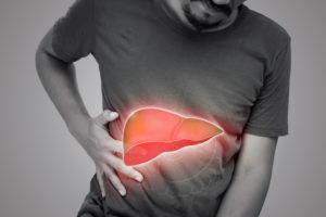 Ciroza hepatica